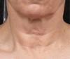 Laser Skin Treatments