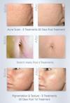 Other Procedures