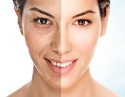 Dermapeels